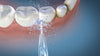 IRRIGADOR BUCAL 3  colores